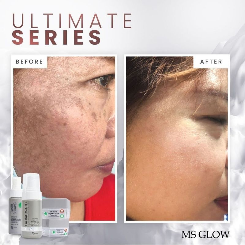 (Original 100%) Ms Glow Paket Wajah Luminous/Whitening/Acne/Ultimate / Paket Wajah Ms Glow