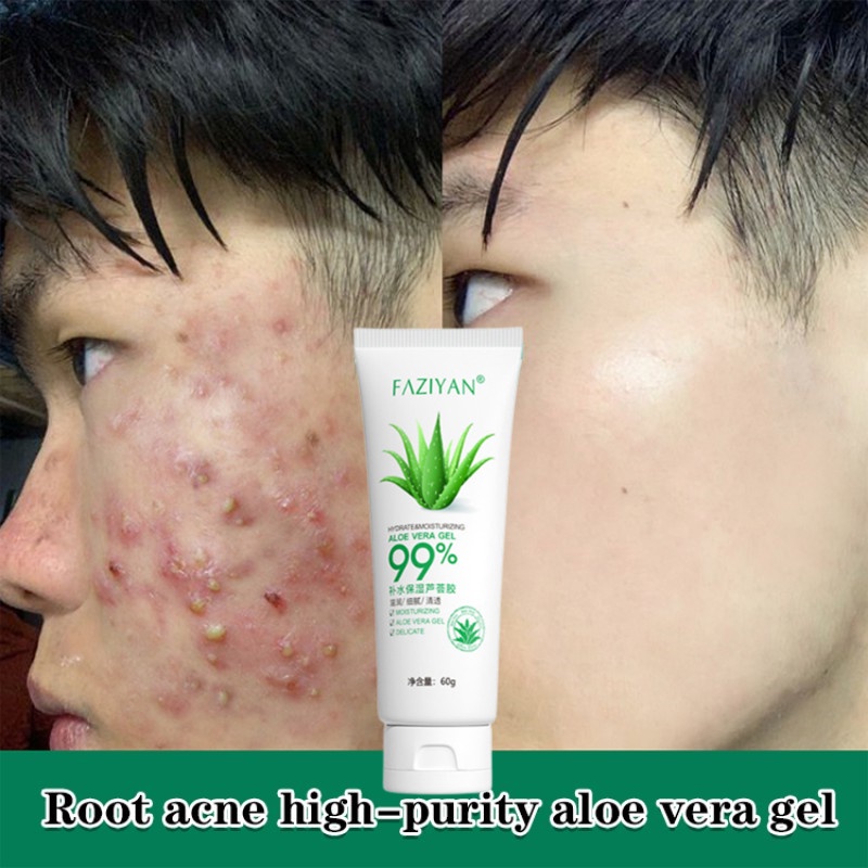 ALOE VERA SOOTHING GEL EKSTRAK LIDAH BUAYA MELEMBABKAN KULIT 100% Ekstrak Lidah Buaya