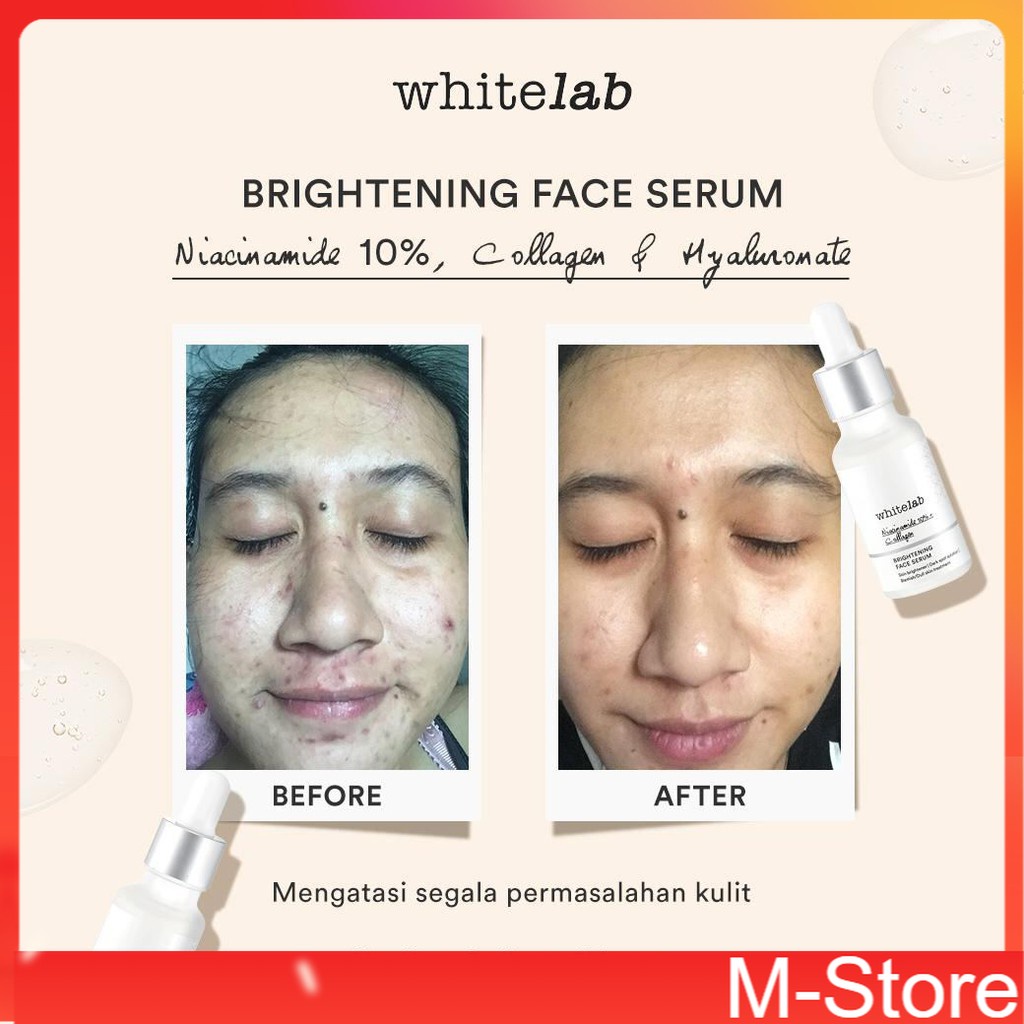Whitelab - Brightening Face Serum