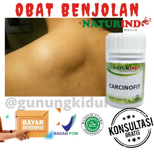 OBAT HERBAL BENJOLAN KANKER TUMOR BISUL JERAWAT BATU LIPOMA UCI UCI HERBAL CARCINOFIT NATURINDO COD-4