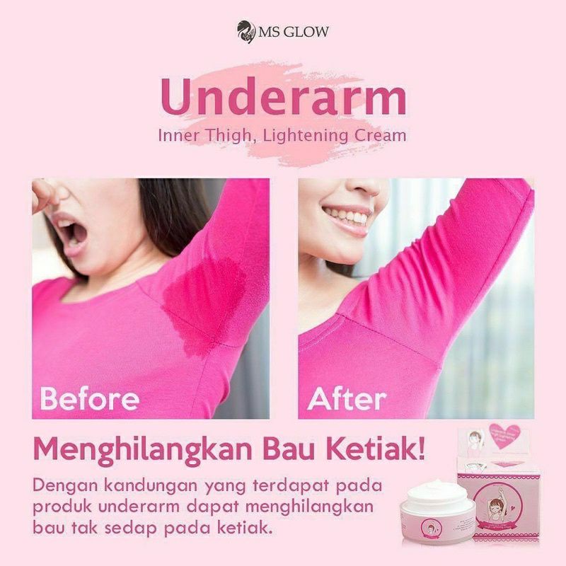 UNDERARM PEMUTIH KETIAK MS GLOW [BPOM]