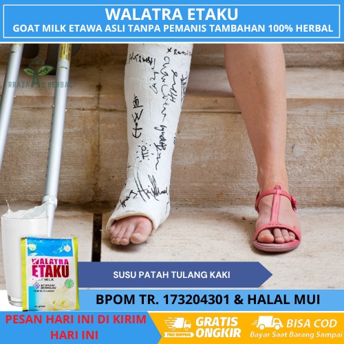 Susu Patah Tulang Anak dan Dewasa - Obat Patah Tulang, Tulang Retak, Tulang Bergeser, Tulang Pembeng
