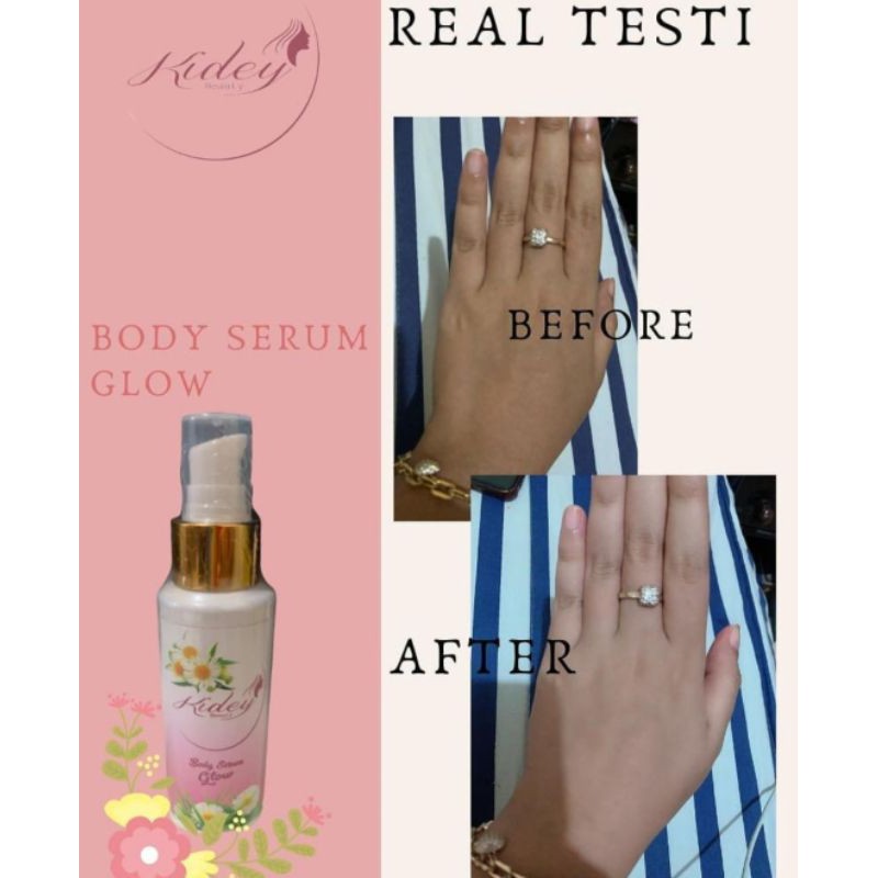 Body serum glow by kidey beauty