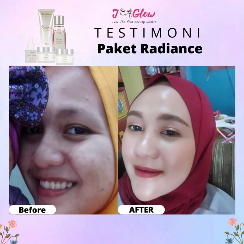 JGLOW PAKET RADIANCE /SKINCARE BPOM / SKINCARE JGLOW SUPER ORIGINAL