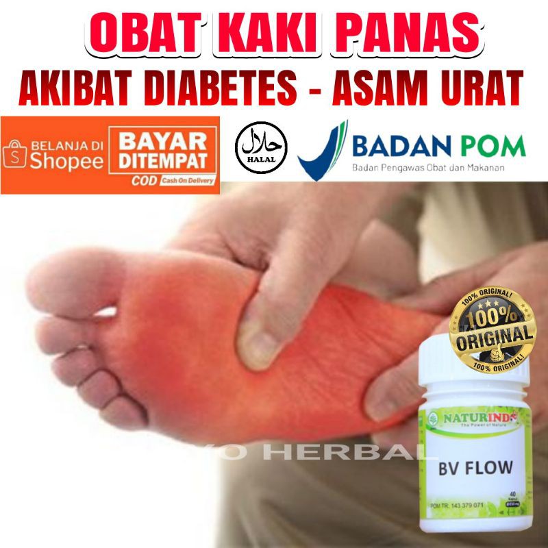 Obat kaki panas akibat dabetes Asam urat memperlancar aliran darah