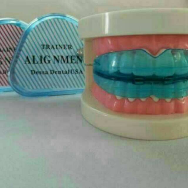 Karet Behel Perapi gigi renggang maju bertumpuk bukan bracket kawat gigi lepas pasang Kualitas Super