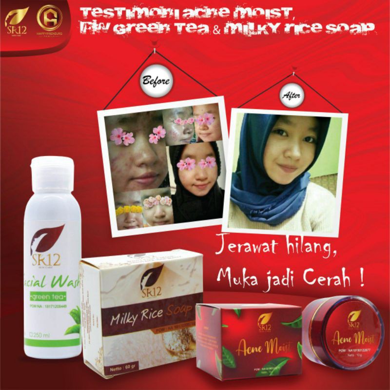 PAKET KHUSUS JERAWAT/PAKET ACNE SERIES/PAKET SOLUSI JERAWAT / JERAWAT RINGAN /JERAWAT SEDANG / Paket perawatan wajah berjerawat original / premium / berkualitas / termurah / terbaik / bagus / bpom / saudagarsr12