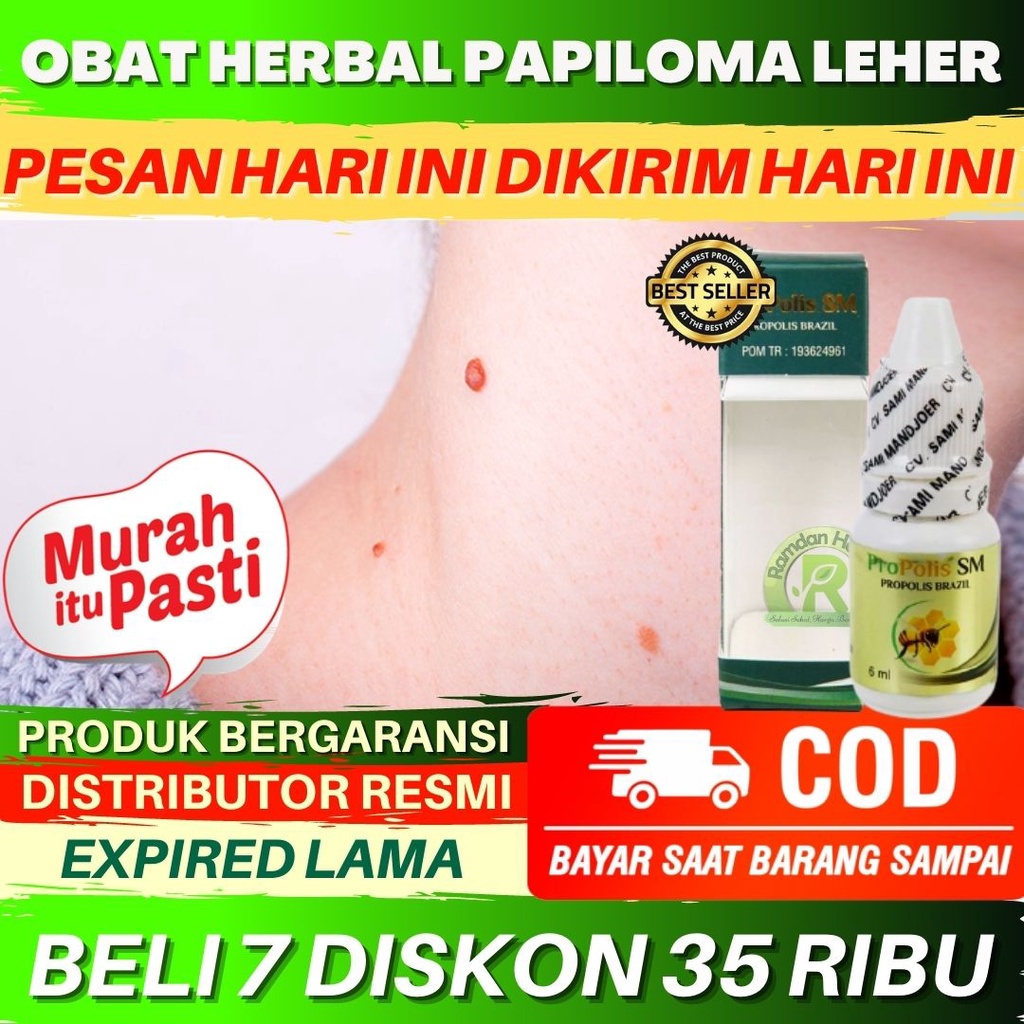 Obat Papiloma Leher Obat Kutil Leher Obat Papiloma Perontok Kutil Penghilang Kutil Skin Tag Propolis