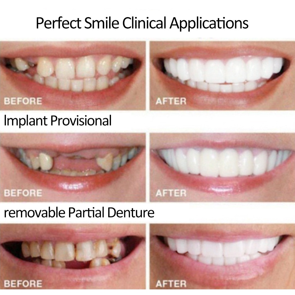 Snap On Smile 100% Original Veneer Gigi Palsu Atas Bawah Instan Gigi Palsu Vener Silikon Alami Authentic Pemutih Gigi