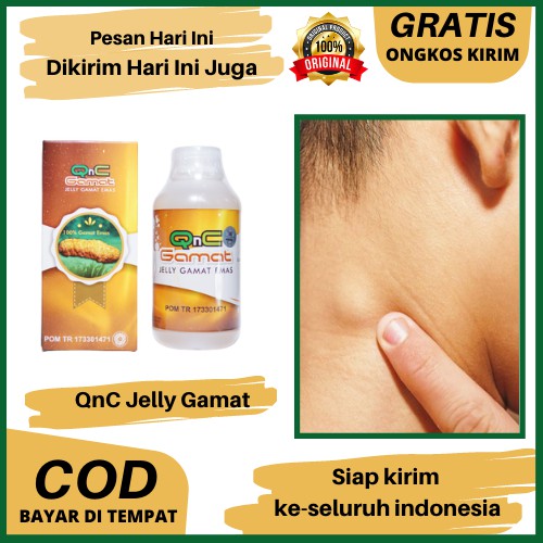Obat Kelenjar Getah Bening Di Leher, Ketiak, Selangkangan Herbal Qnc