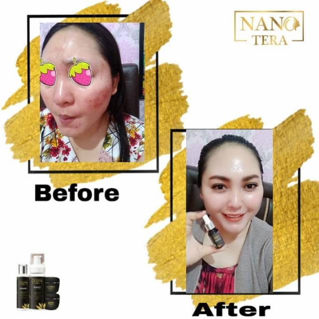 (COD)NANOTERA SKINCARE (BELI PAKET KOMPLIT BONUS POUCH/TAS DAN SERUM ANTI AGING NANOTERA,BURUAN ORDER YUK).