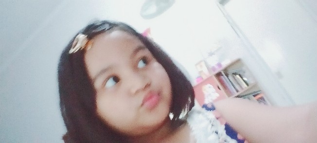 Centong Nasi Ajaib, Centong Nasi Buka Tutup Otomatis, Centong Nasi Anti Lengket