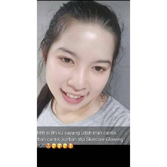 MurahBanget Wp Skincare Whitening Glow Series ✬♙♤