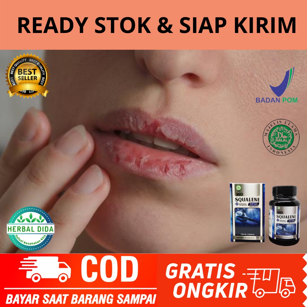 Obat Bibir Pecah Pecah, Obat Bibir Luka, Obat Bibir Pecah Kering, Pemerah Bibir Alami, Bibir Pecah-P