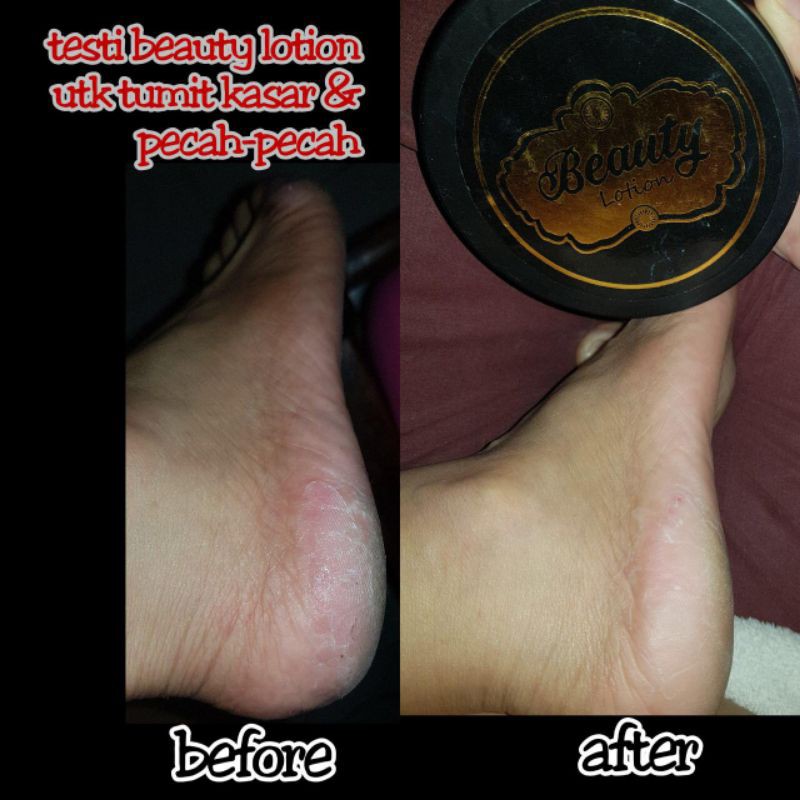 BEAUTY LOTION DAN BEAUTY SCRUB ORIGINAL RK COSMETICS PENCERAH ALAMI KULIT BPOM