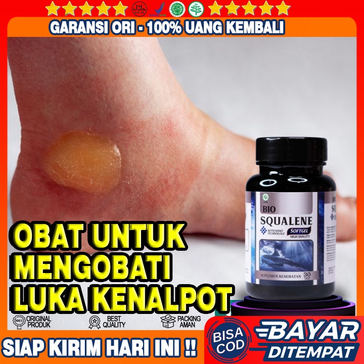 Obat Luka Kena Knalpot - Obat Luka Bakar Knalpot Melepuh Menggelembung - Herbal Luka Knalpot - Obat 