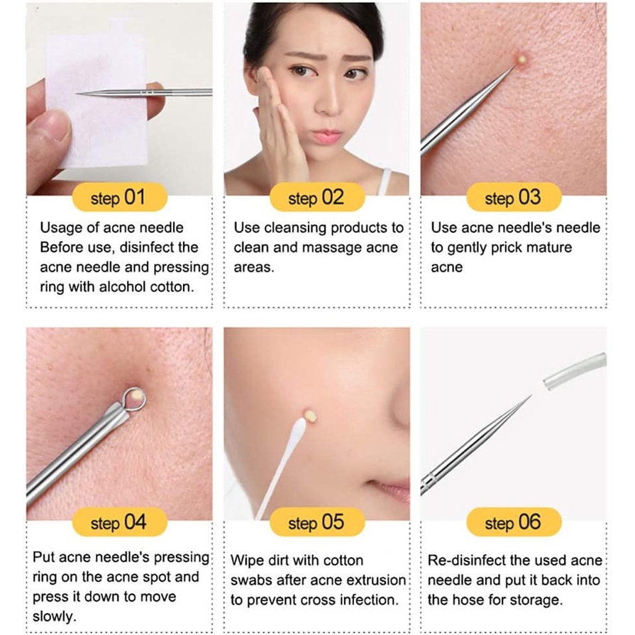 Alat Pinset Facial Pencetan Jerawat Komedo Acne Removal Remover 4Pcs