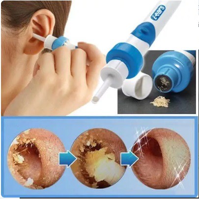 I-EARS / Ears Cleaner ~ Vakum Pembersih Kotoran Telinga ~ Korek Kuping