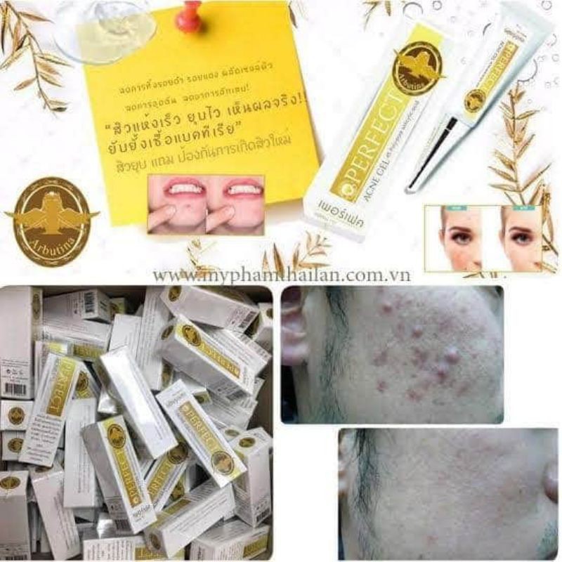 

perfect acner gel