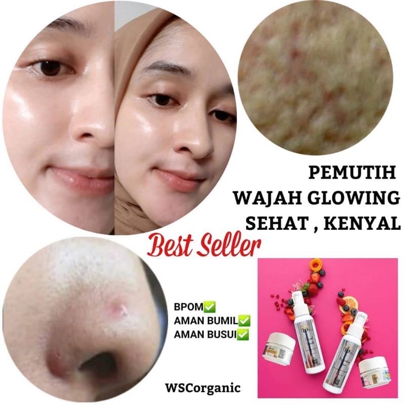 WSC ORGANIC Cream wajah BPOM |Glowing series |Paket Normal Flek Jerawat bopeng |skincare sesuai kelu