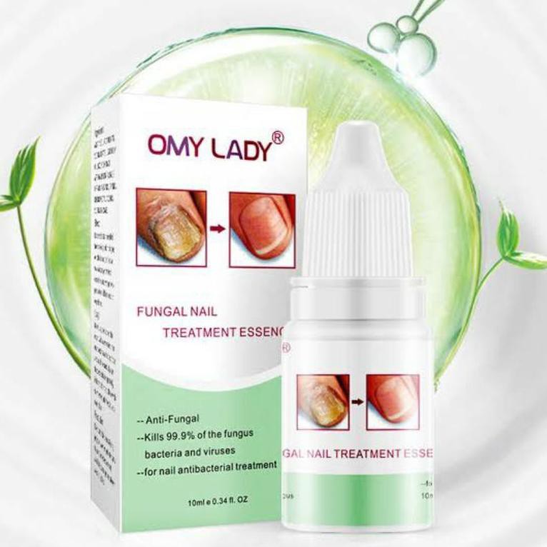 M@sh R3ady>VITAMIN KUKU / OBAT KUKU JAMUR OMY LADY FUNGAL NAIL TREATMENT / PERAWATAN KUKU / MANICUR