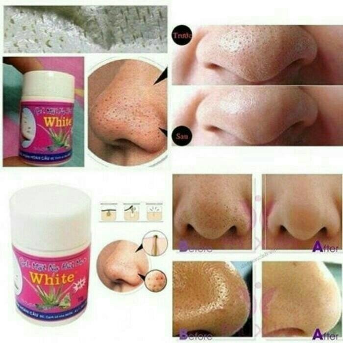 TERAMPUH GEL MAT NA HUT MUN WHITE . GELMATNA HUTMUN . ALAT PENGHILANG PENCABUT KOMEDO BEHELLDENTAL
