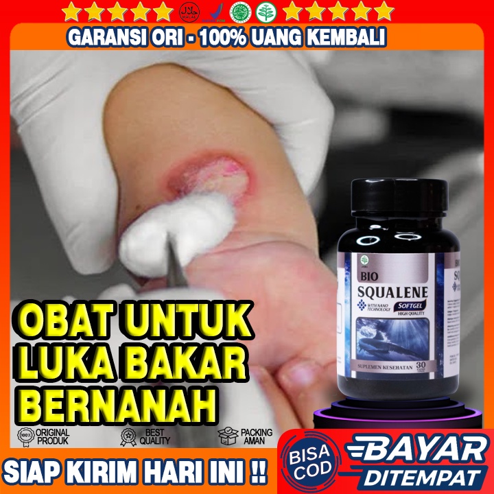 Obat Luka Bakar Bernanah - Obat Luka Menggelembung dan Berair - Obat Luka Tersiram Air Panas - Obat 
