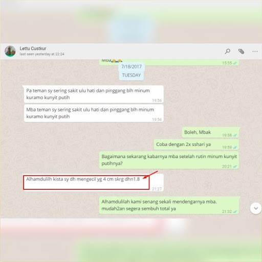 Kuramo Kunyit Mas Original | Asam Lambung | Penambah Nafsu Makan | Obat Herbal Alami 200g | Pandanus-3