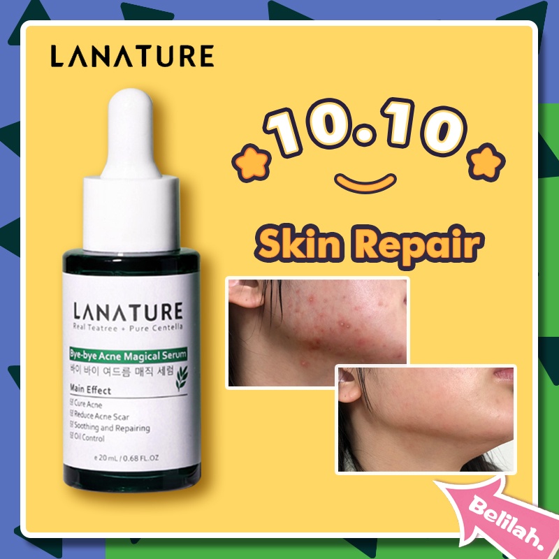 Lanature Niacinamide hyaluronic acid serum /La nature Acne Spot Treatment Cream /Lanature Acne Serum
