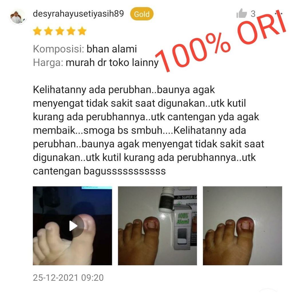 ˆ879¹ Obat Cantengan Sakit Kuku Jempol Kaki Super green plus JK-7