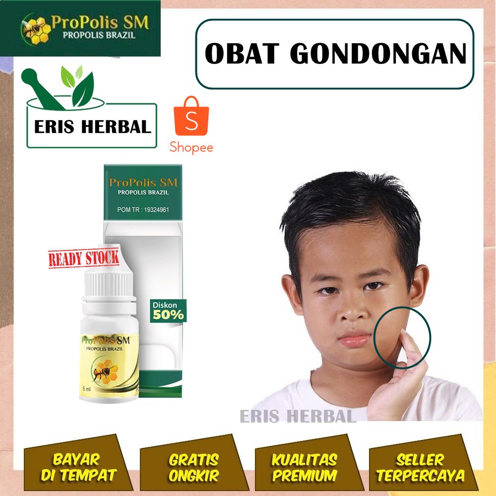 Bengkak Di Leher Kanan Jual Obat  Gondok Amandel 