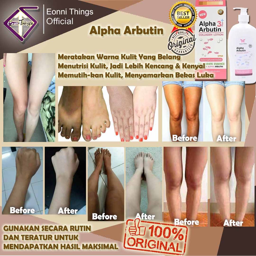 Cara menghilangkan bekas luka lama yang memutih