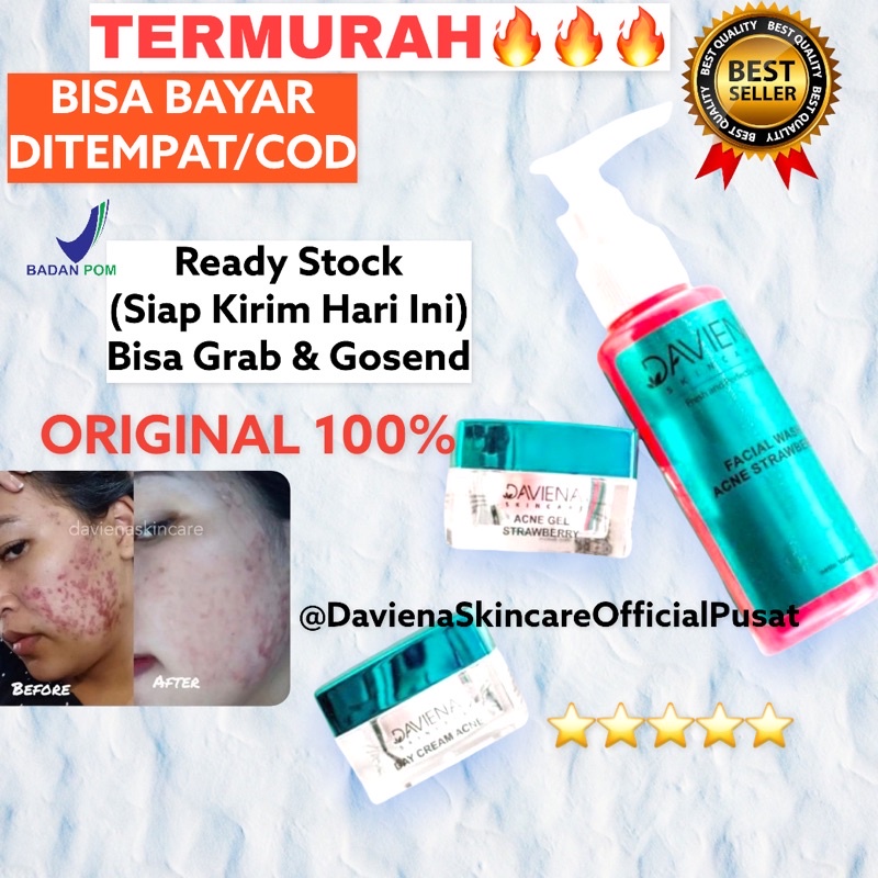 BEST DAVIENA SKINCARE PAKET HEMAT ACNE 1 (ACNE GEL | DAVIENA | DAVIENA SKINCARE | DAVIENASKINCARE Davina ASLI 100% Krim Cream Wajah Mengatasi Jerawat Bekas Jerawat Bopeng Pori Pori Besar FLEK Noda Hitam Kulit Kusam Jadi Glowing dan Sehat OFFICIAL ORIGINAL