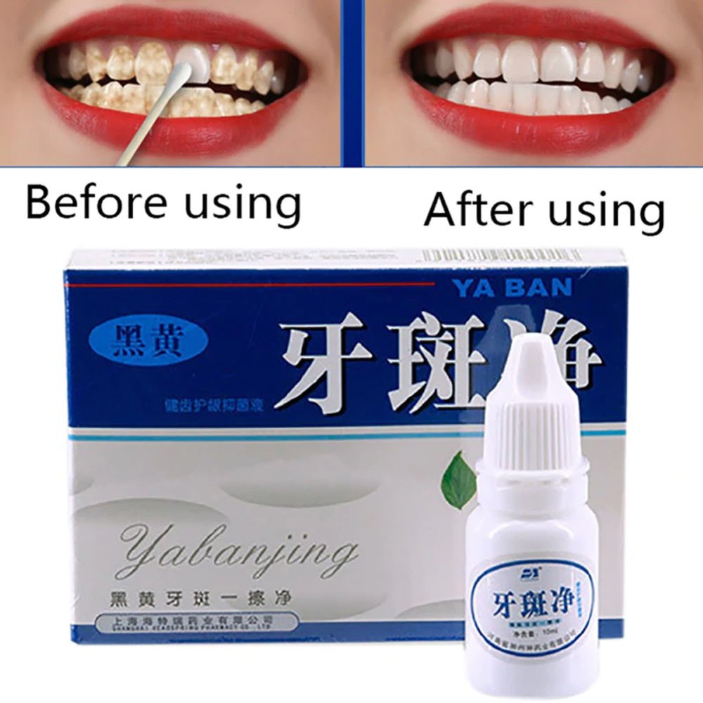 ORIGINAL 100% YABANJING PEMUTIH PEMBERSIH GIGI KUNING PENGHILANG PERONTOK KARANG GIGI 100% AMAN MANJUR TERBUKTI WHITENING TEETH ODOL CAIRAN CREAM