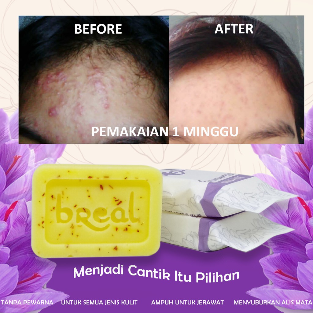 Sabun Jerawat Dan Bekas Jerawat Pria Wanita Organik Safron Soap Saffron Bopeng BREAL Sabun Safron 20