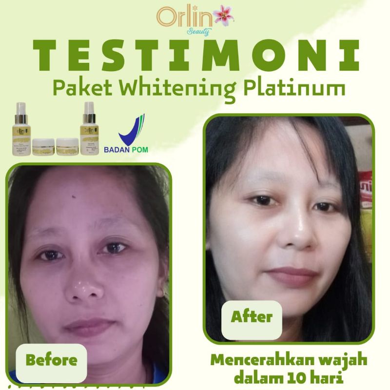 ( FREE HADIAH )ORLIN BEAUTY / ORLIN BEAUTY SKINCARE / ORLIN SKINCARE / PUTIH GLOWING 10HARI