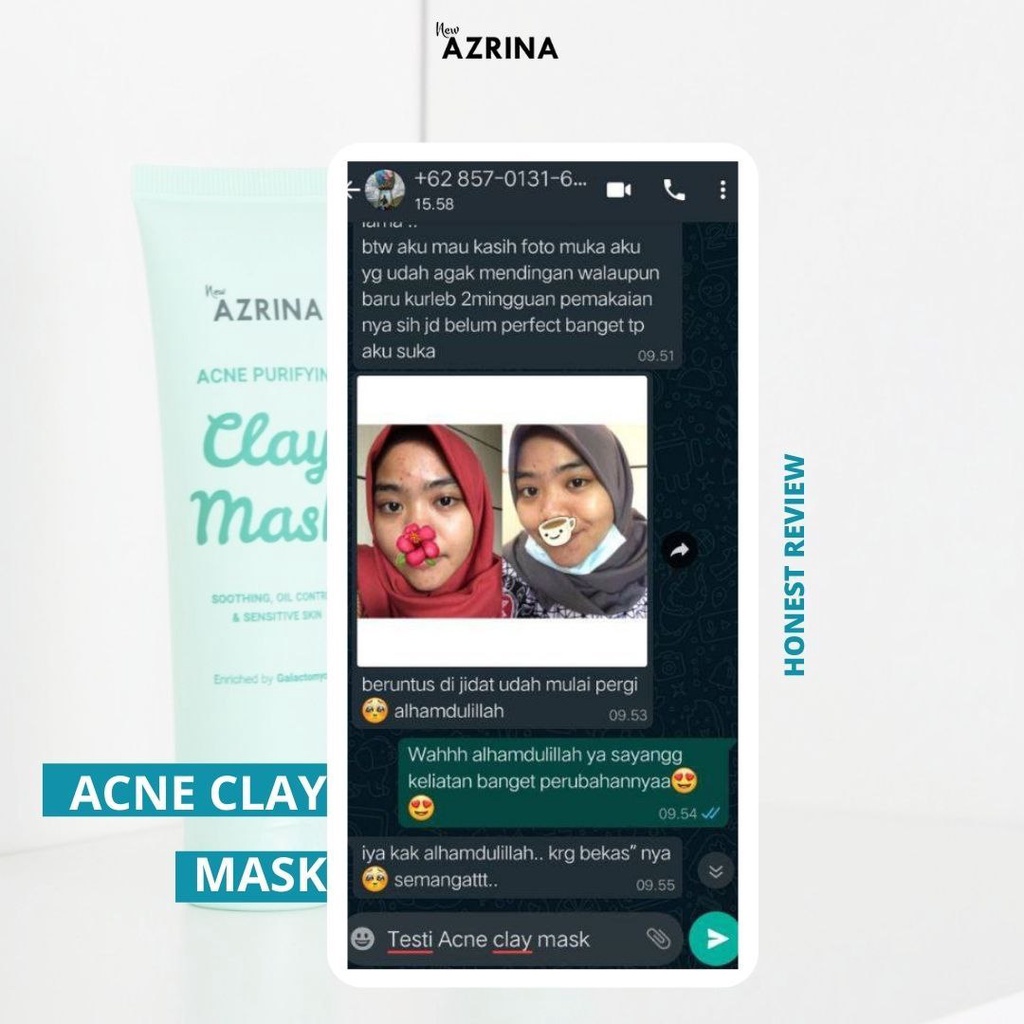 READY SIAP KIRIM!AZRINA PURE CHARCOAL MASK 50 ML| AZRINA ACNE PURIFYING CLAY MASK 50ML MASKER CHARCOAL AZRINA MUD MASK CHARCOAL CLAY MASK AZRINA ACNE MASK PERAWATAN MASKER WAJAH AMAN BPOM PERAWATAN KULIT BERJERAWAT BERKOMEDO PENGANGKAT PENGHILANG JERAWATK