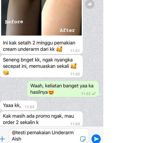 ▼ Aish C Bright Underarm Cream | Aish Serum | Aish Neck Brightening | C-Bright Serum dan Cream Untuk