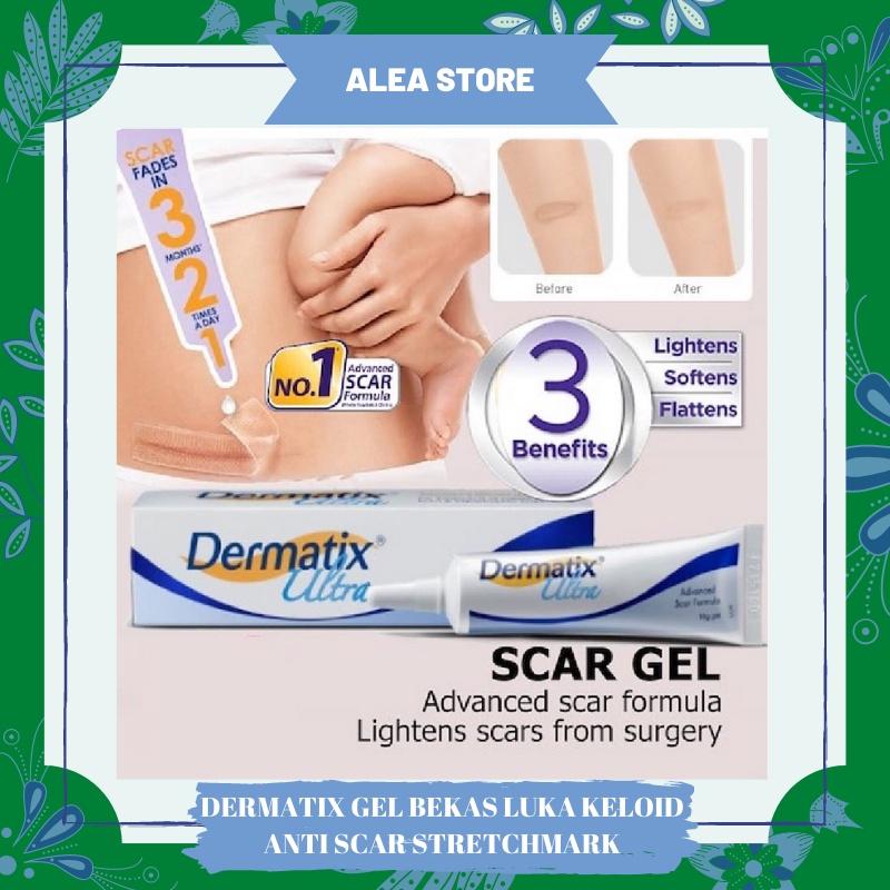 Dermatix Ultra Gel 15g Penghilang Bekas Luka / Keloid ANTI SCAR Stretchmark 15 Gram Dermatik Original