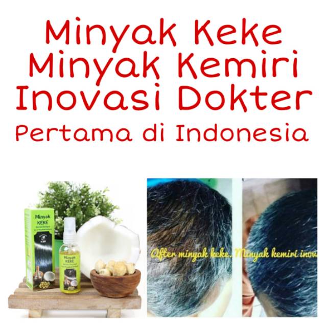 MINYAK KEKE, PENUMBUH RAMBUT, MINYAK KEMIRI, MIKEKE, MINYAK KEMIRI BAYI, PENUMBUH RAMBUT BAYI,