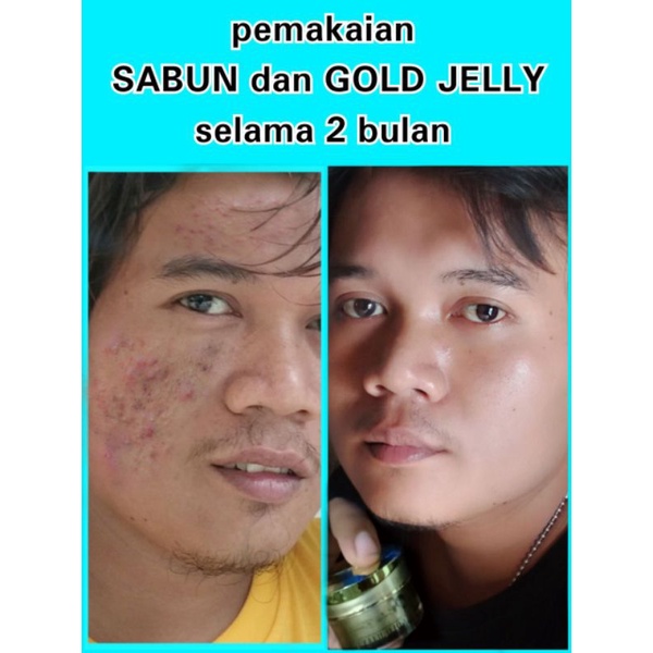 SABUN KEDASBEAUTY BRIGHTENING SOAP-1