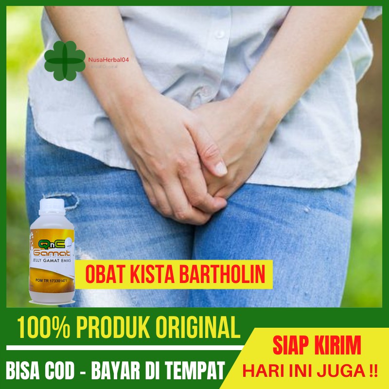 Obat Kista Bartholin, Benjolan di Bibir Vagina, Kelenjar Bartholin Bengkak, Herbal Kista Bartholini,