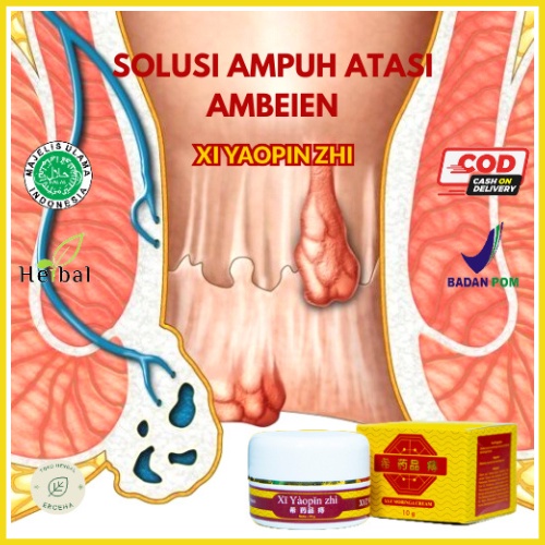 Saleb Xi Yaopin Zhi Herbal Mengobati Ambeien Pada Anus Bokong Selangkangan Mengatasi Gejala Ambeyen Tanpa Operasi Aman Lembut Tidak Menimbulkan Efek Samping Dan Ketergantungan