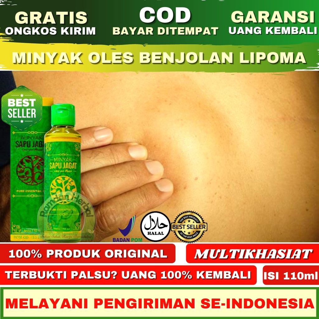 Obat Herbal Benjolan Lipoma Minyak Oles Lipoma Minyak Oles Benjolan Minyak Oles Sapu Jagat