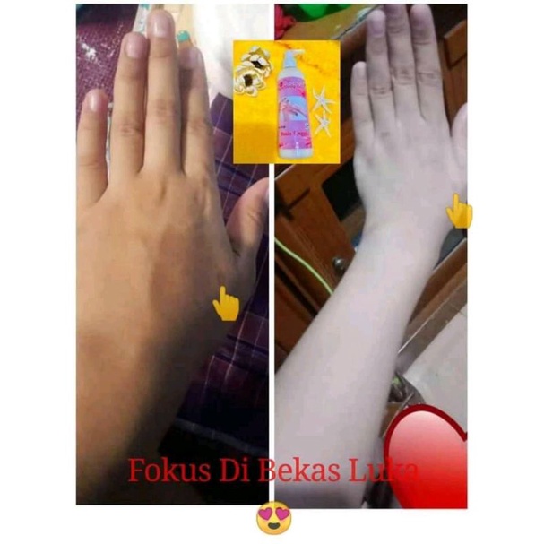 hb Korea Dosting by FTRglow handbody korea