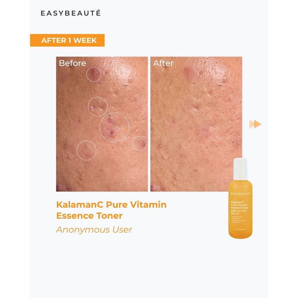 Easybeaute KalamanC Pure Vitamin Essence Toner 100ml - Brightening Skin / Kalapack