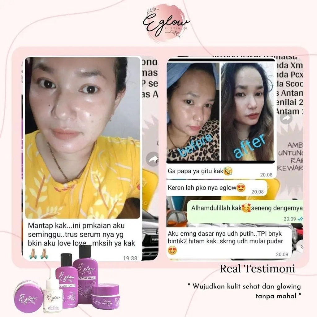 ( SALE JUAL CEPAT ) Eglow Skincare Original