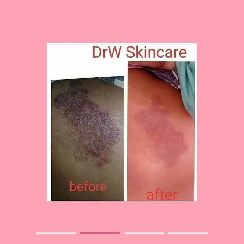 SABUN PEMUTIH Ekstra Whitening (Kojic Milk &amp; Sulfur) by drw skincare