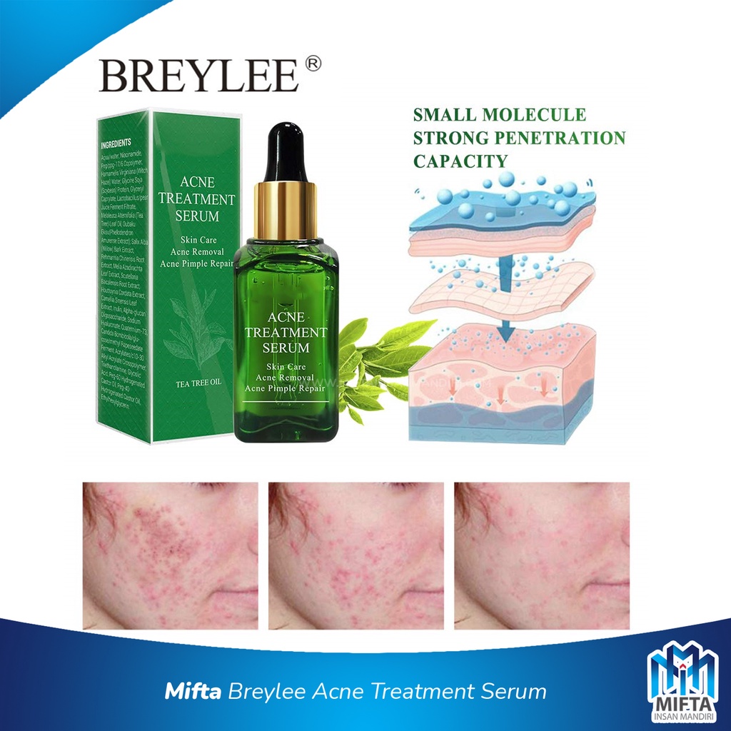 BREYLEE ACNE TREATMENT SERUM / SKIN CARE PENGHILANG BEKAS JERAWAT