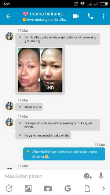 EL-SHA Paket FLEK & JERAWAT GLOWING-Tanpa Pengelupasan Memutihkan dan Mencerahkan Kulit Wajah